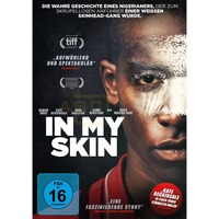 In my Skin
