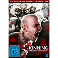 Skinning - We are the law